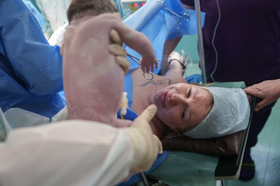 Un médico muestra a Olha Karpenko a su hija recién nacida, Diana, por primera vez tras su nacimiento por cesárea.