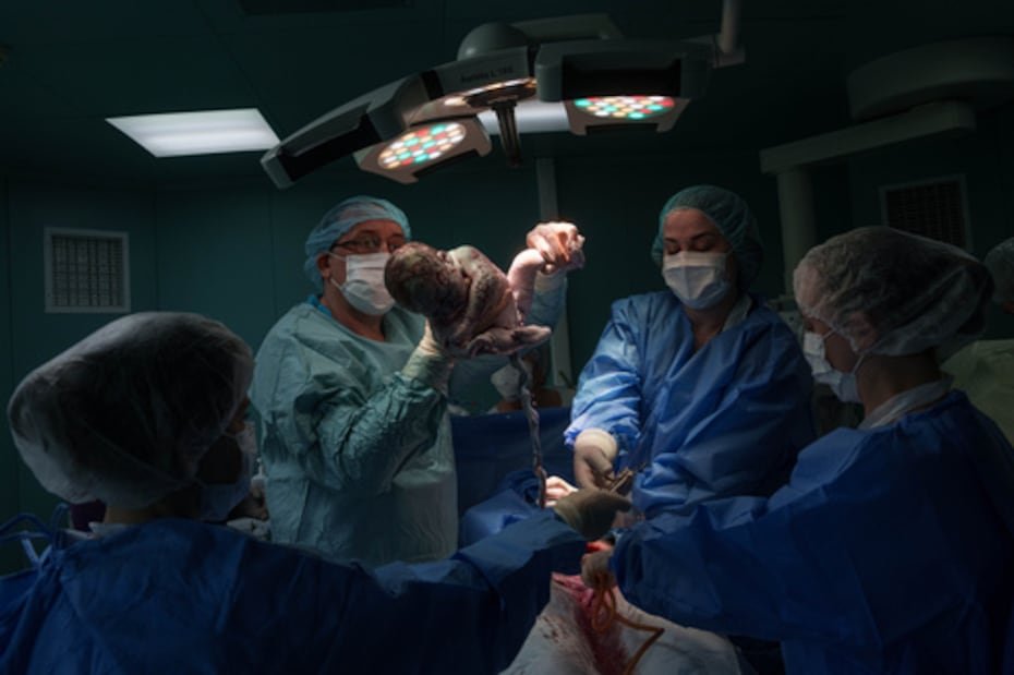 Un médico sostiene a una recién nacida, Diana, tras practicar una cesárea a su madre, Olha Karpenko.