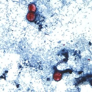 lechuga ciclosporiasis