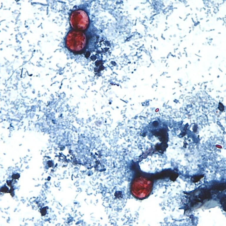 lechuga ciclosporiasis
