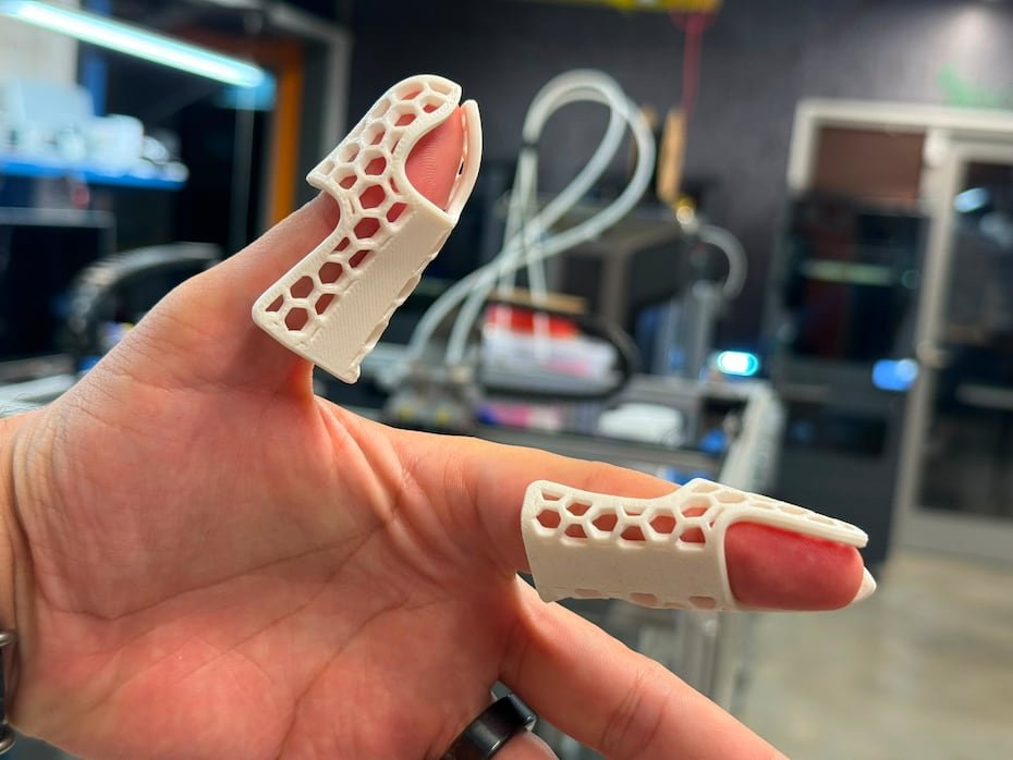 Los esquinces y fracturas están entre las lesiones más frecuentes tras un terremoto. En el centro de innovación Engine-4, en Bayamón, las impresoras 3D están produciendo férulas ("splints") para suplirlas a rescatistas en Venezuela. En la foto, dos férulas diseñadas para dedos.