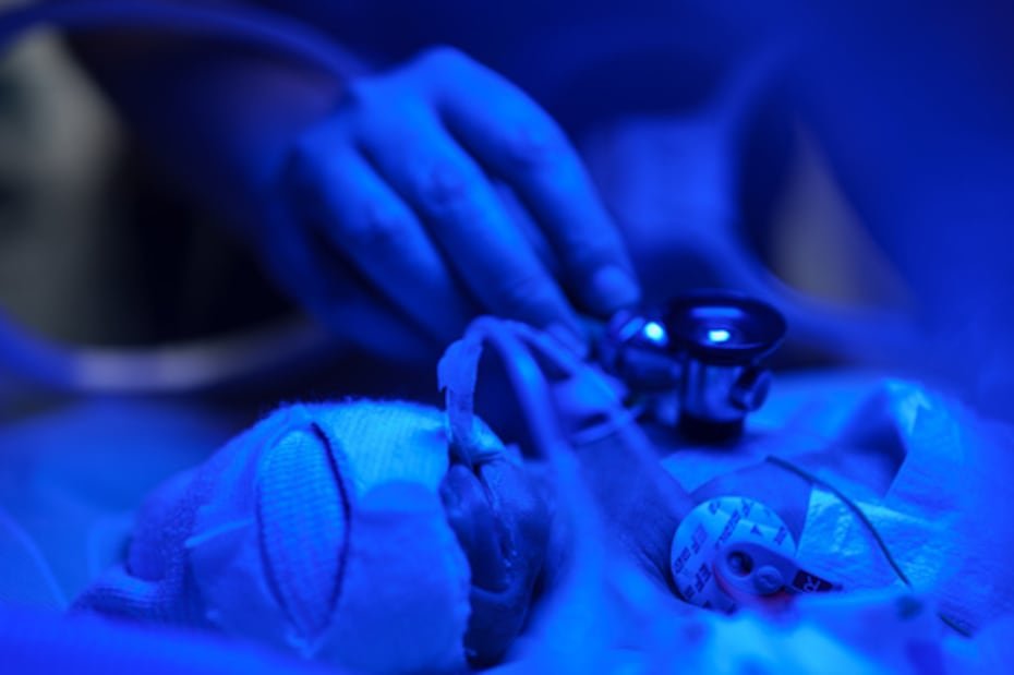 El doctor Andrii Lobanov escucha los latidos del corazón de un bebé prematuro con un estetoscopio dentro de una incubadora de temperatura controlada en un centro perinatal regional.