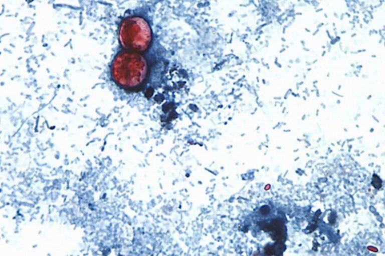 muertes por ciclosporiasis